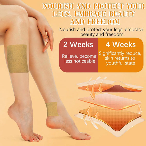 Spider & Varicose Vein Patches | Natural Herbal Therapy for Swelling, Fatigue & Vein Health